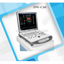 doppler echography portable & doppler ultrasound scanner DW-C60